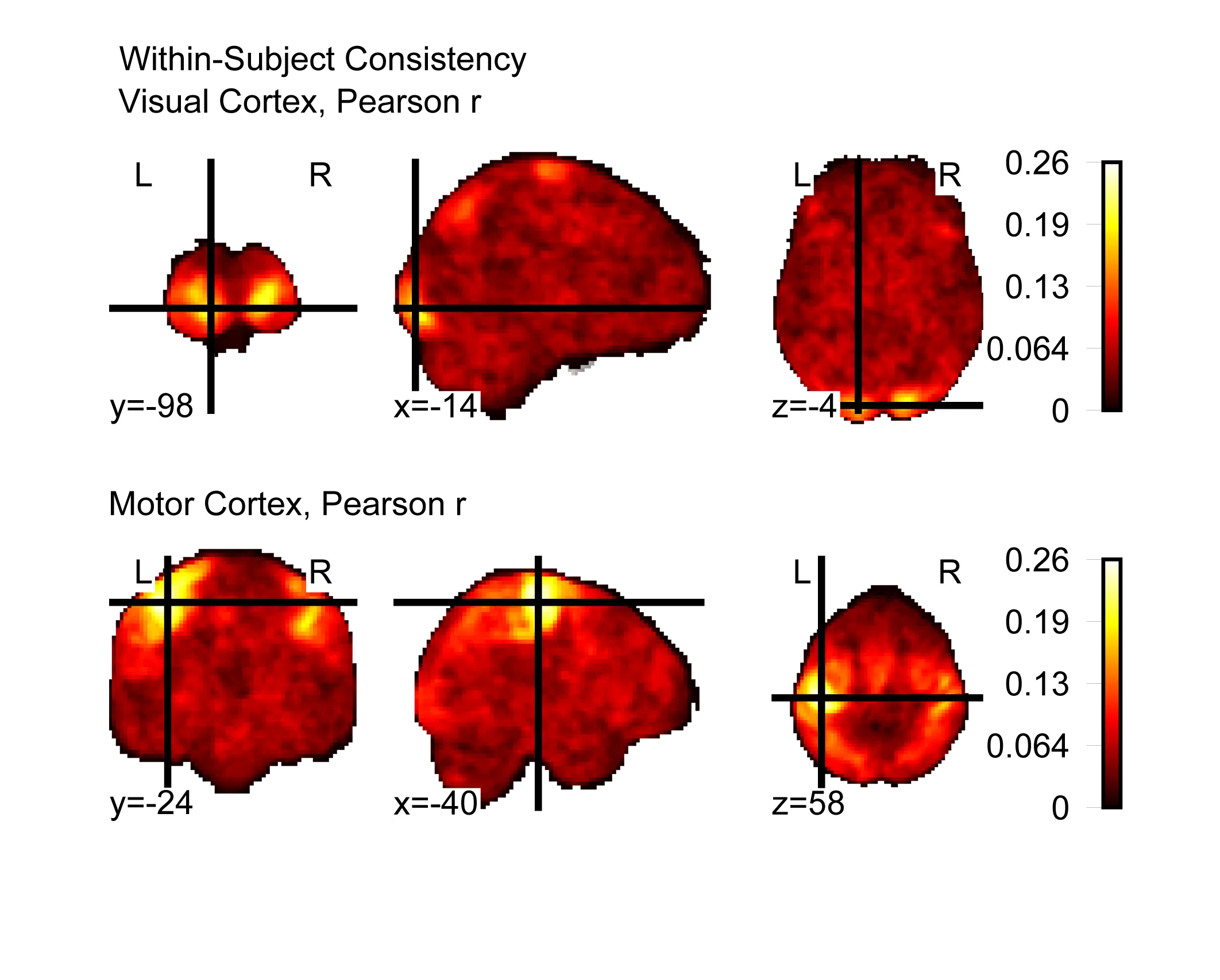 Brain images showing regions where BOLD activity reflects the predictive structure of a learned sequence rather than the identity of individual stimuli.
